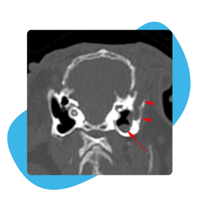 CT image